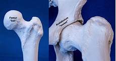 Ball Socket Joint