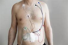 Electrocardiogram Cables